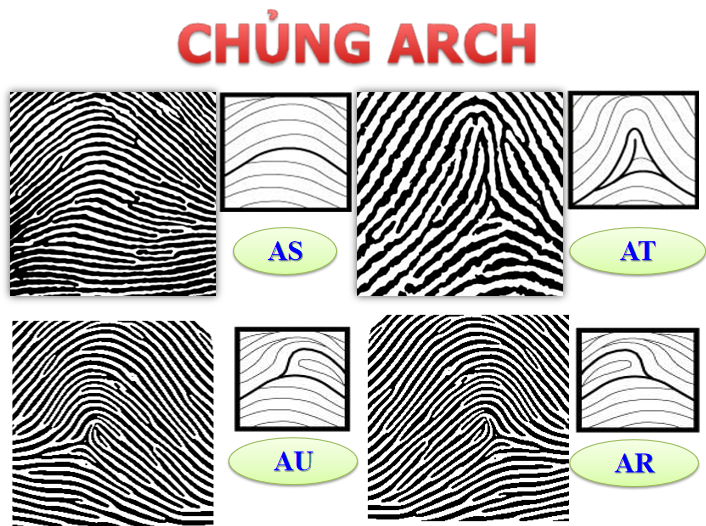 chủng vân tay núi arch