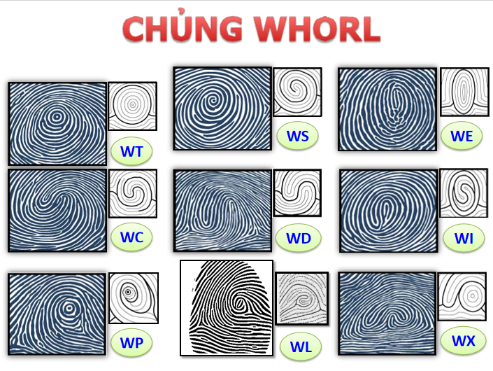 chủng vân tay đại bàng whorl